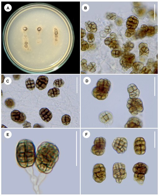 Figure from article: <i>Yunnanomyces syagri</i>...