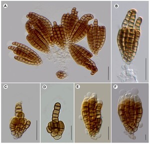 Figure from article: Novel and rare microfungi...